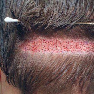 Hair Specialistin